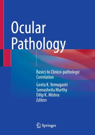 Ocular Pathology 1st Edition by Springer PDF