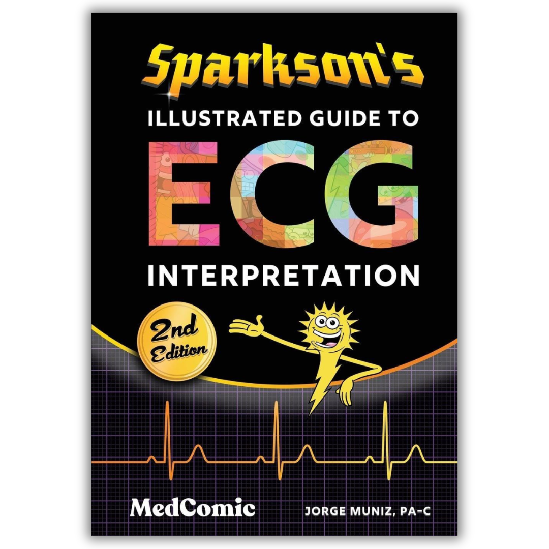 Sparkson’s Illustrated Guide to ECG Interpretation, 2nd Edition (PDF)