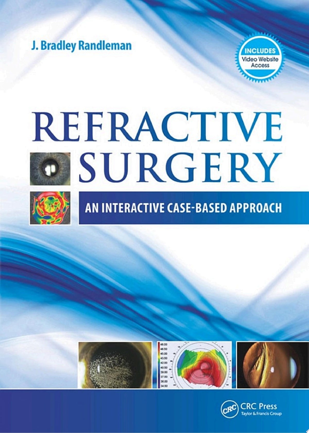 Refractive Surgery 1st Edition by Randleman PDF