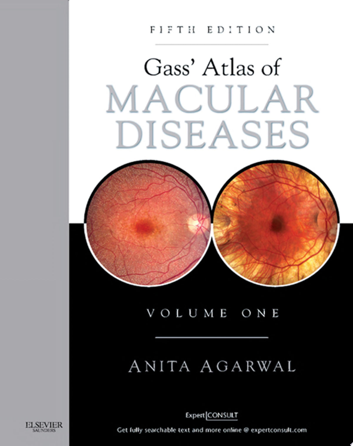 Gass' Atlas of Macular Diseases 2-Volume Set 5th Edition PDF