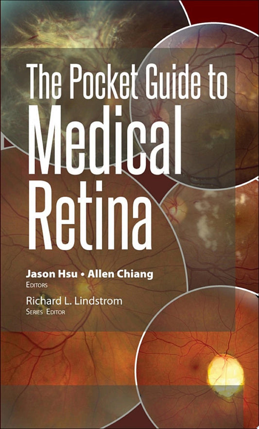 The Pocket Guide to Medical Retina 1st Edition PDF
