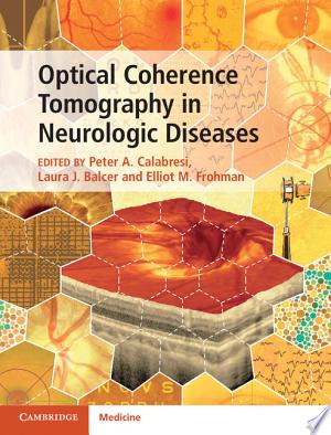 Optical Coherence Tomography in Neurologic Diseases 1st Edition by Cambridge University Press PDF