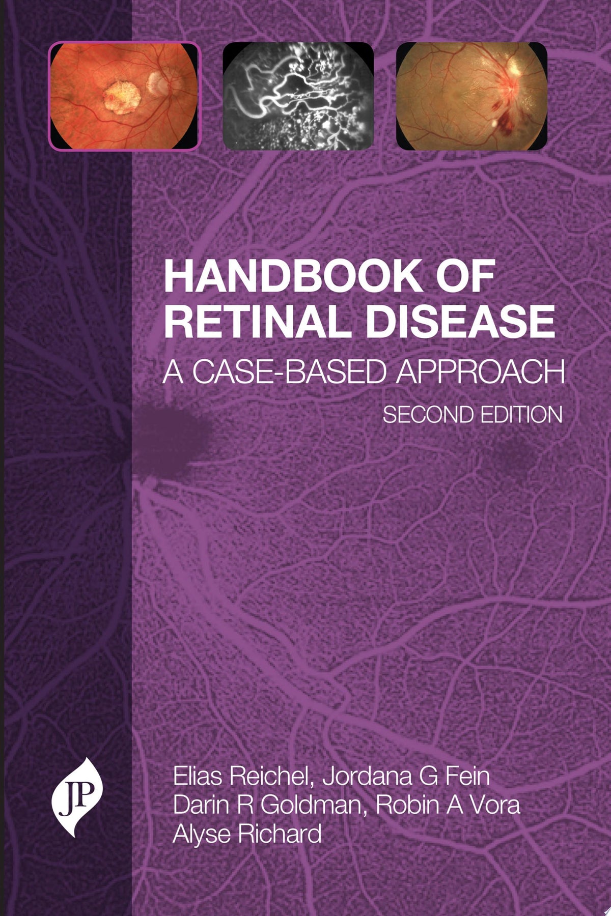Handbook of Retinal Disease: A Case-Based Approach 2nd Edition by Jaypee PDF