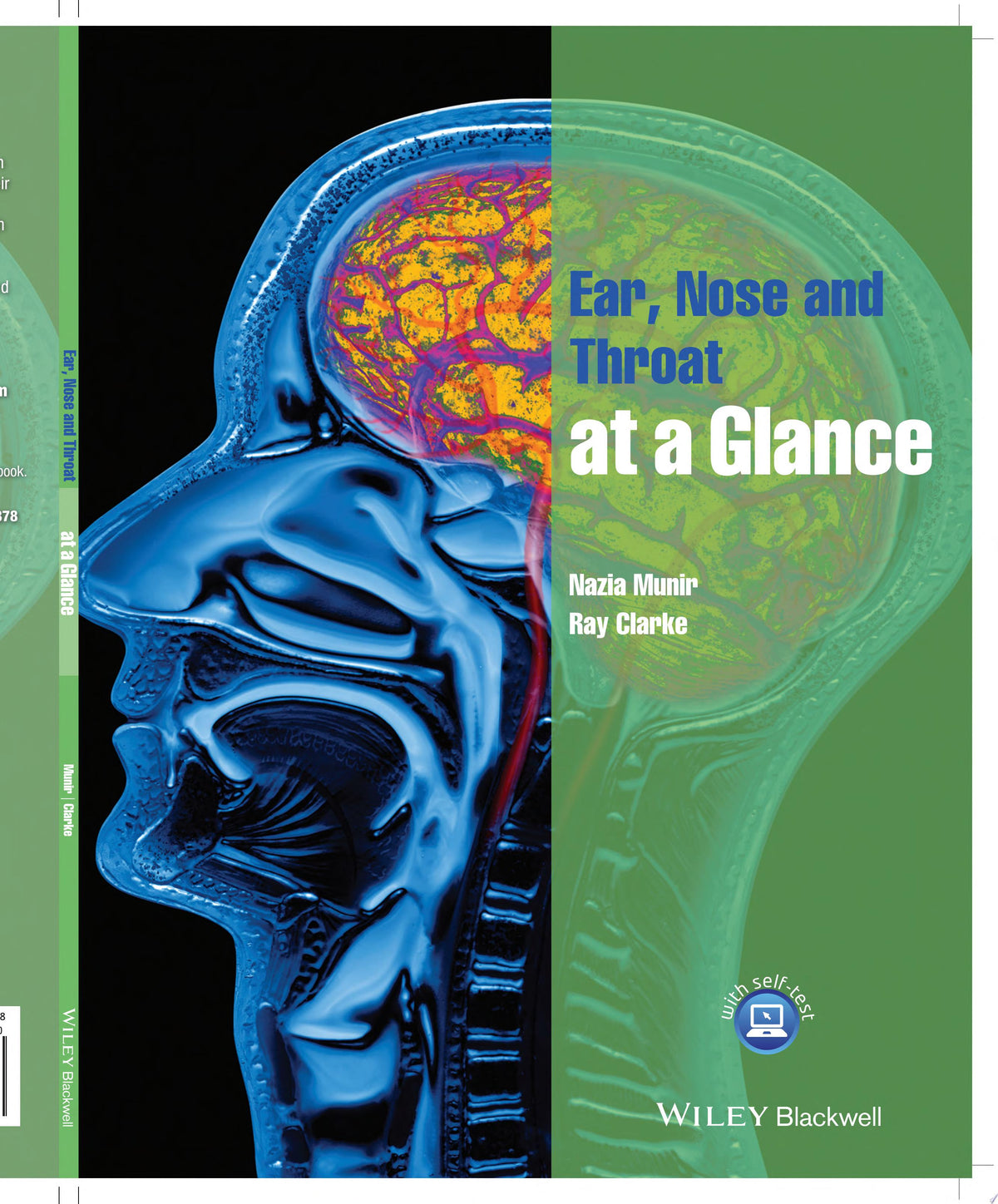 Lecture Notes: Ophthalmology 11th Edition by Wiley-Blackwell PDF