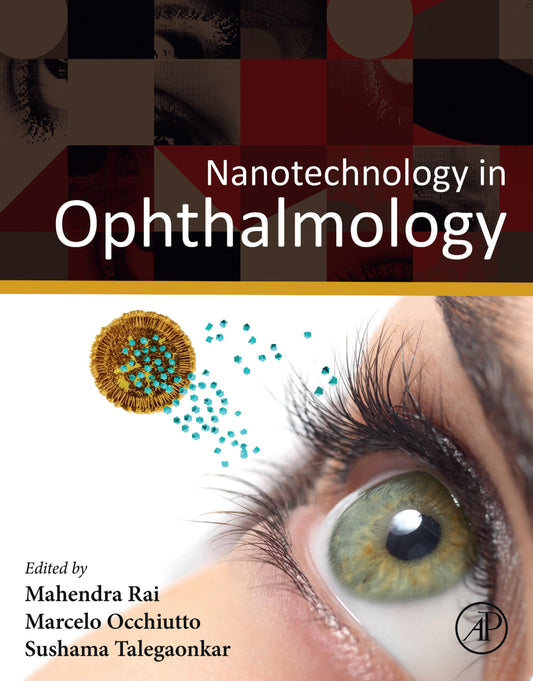 Nanotechnology in Ophthalmology 1st Edition PDF