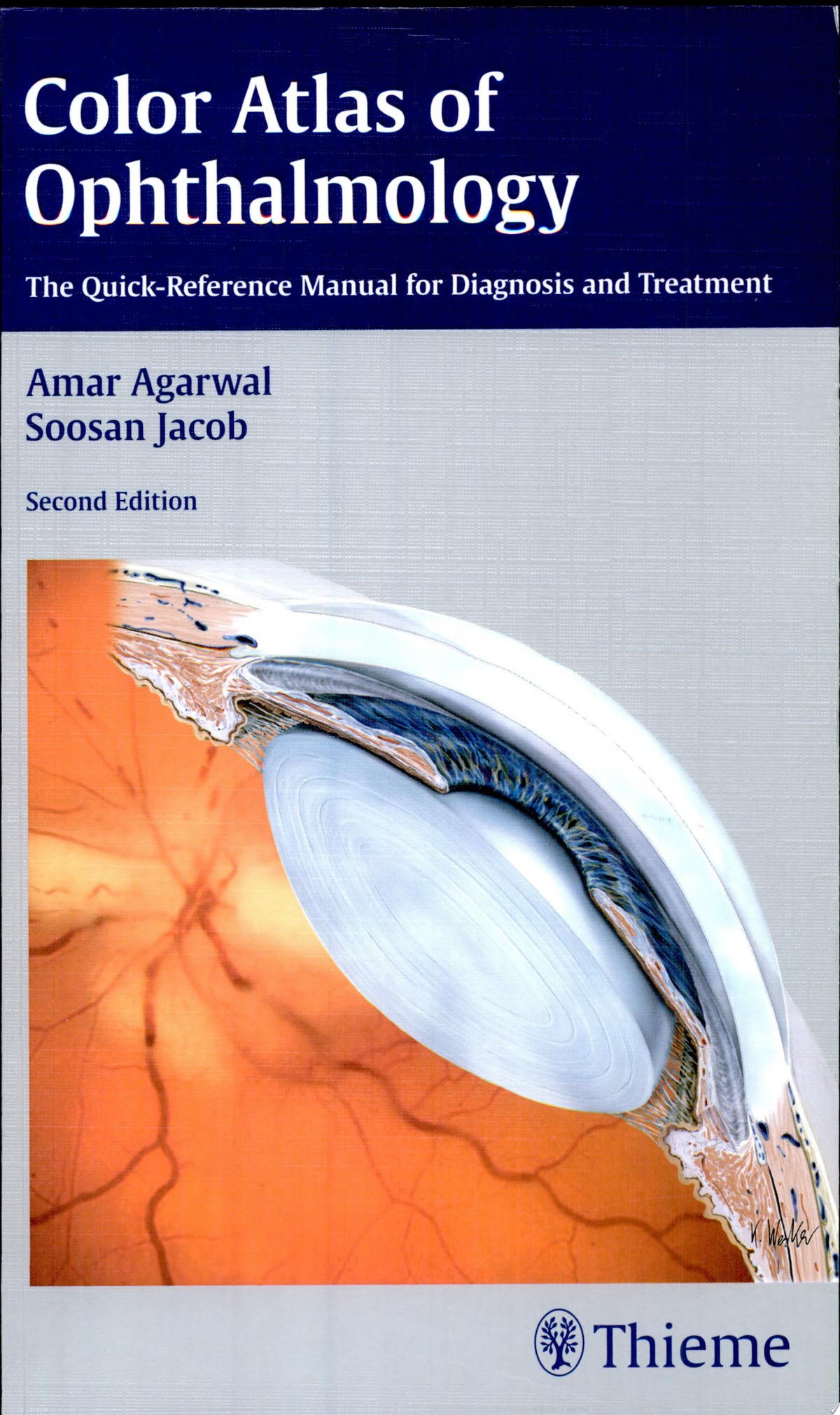 Color Atlas of Ophthalmology 2nd Edition by Thieme PDF