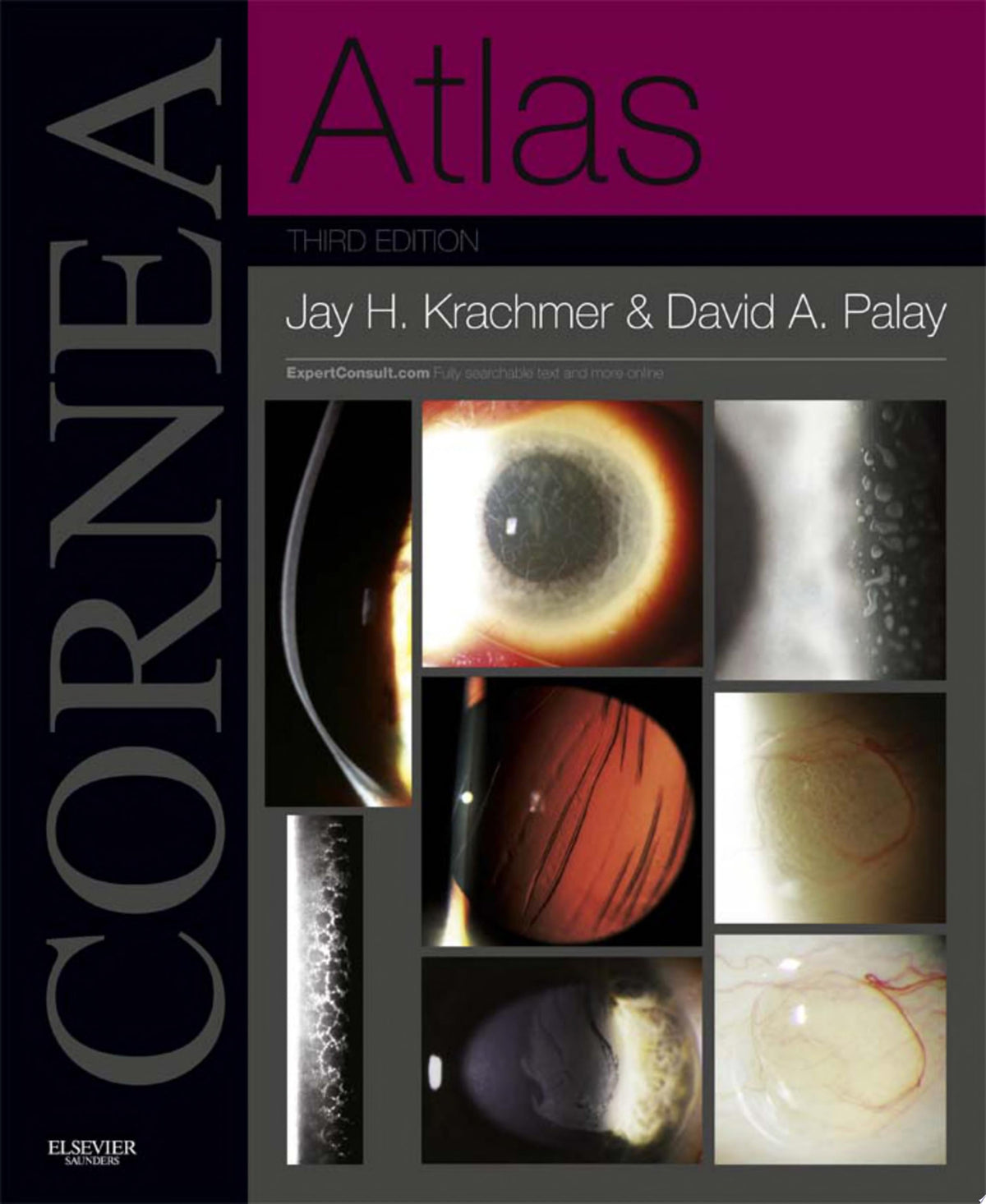 Atlas of Cornea 1st Edition by Krachmer PDF