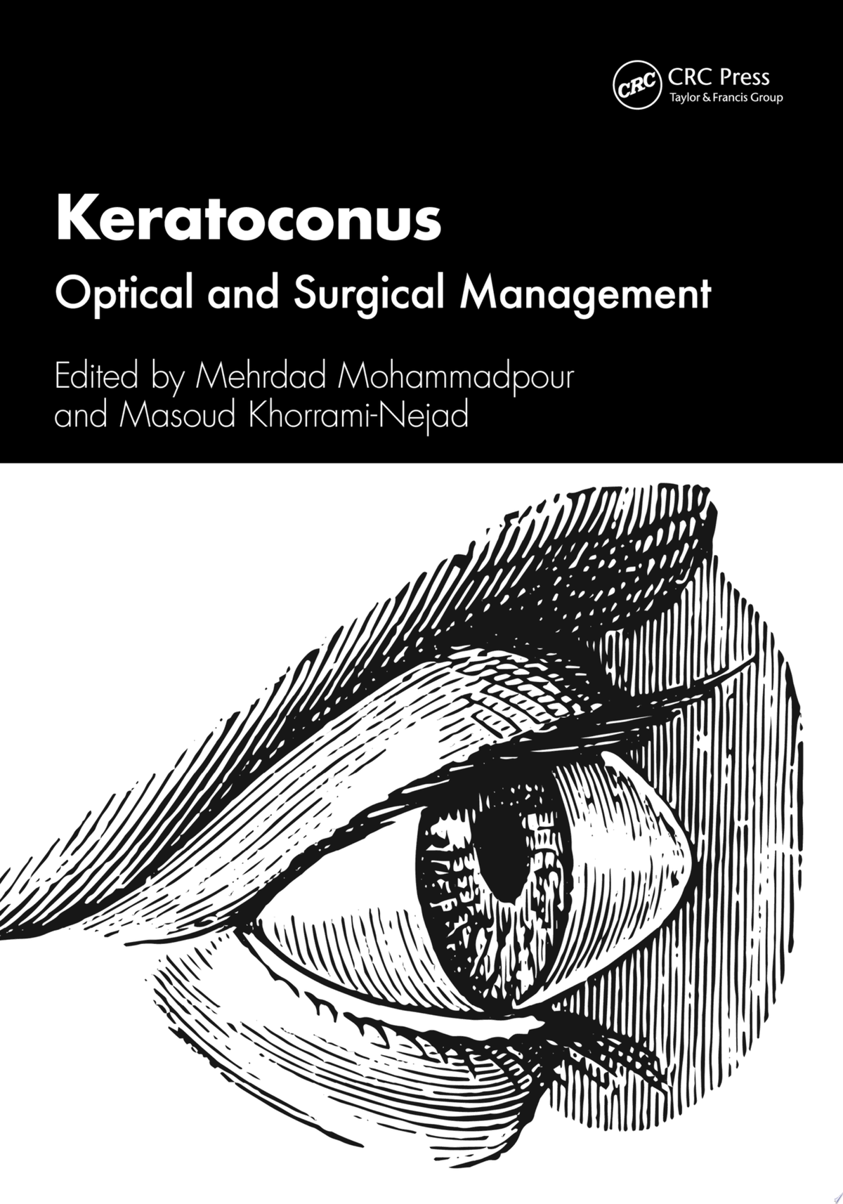 Keratoconus: Optical and Surgical Management 1st Edition by CRC Press PDF