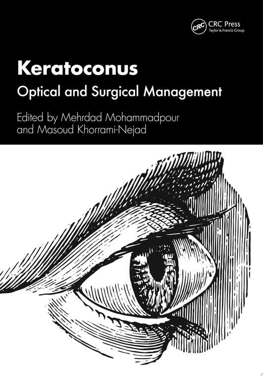 Keratoconus: Optical and Surgical Management 1st Edition by CRC Press PDF