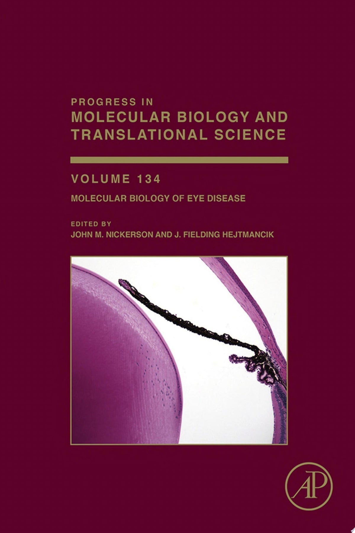 Molecular Biology of Eye Disease 1st Edition PDF