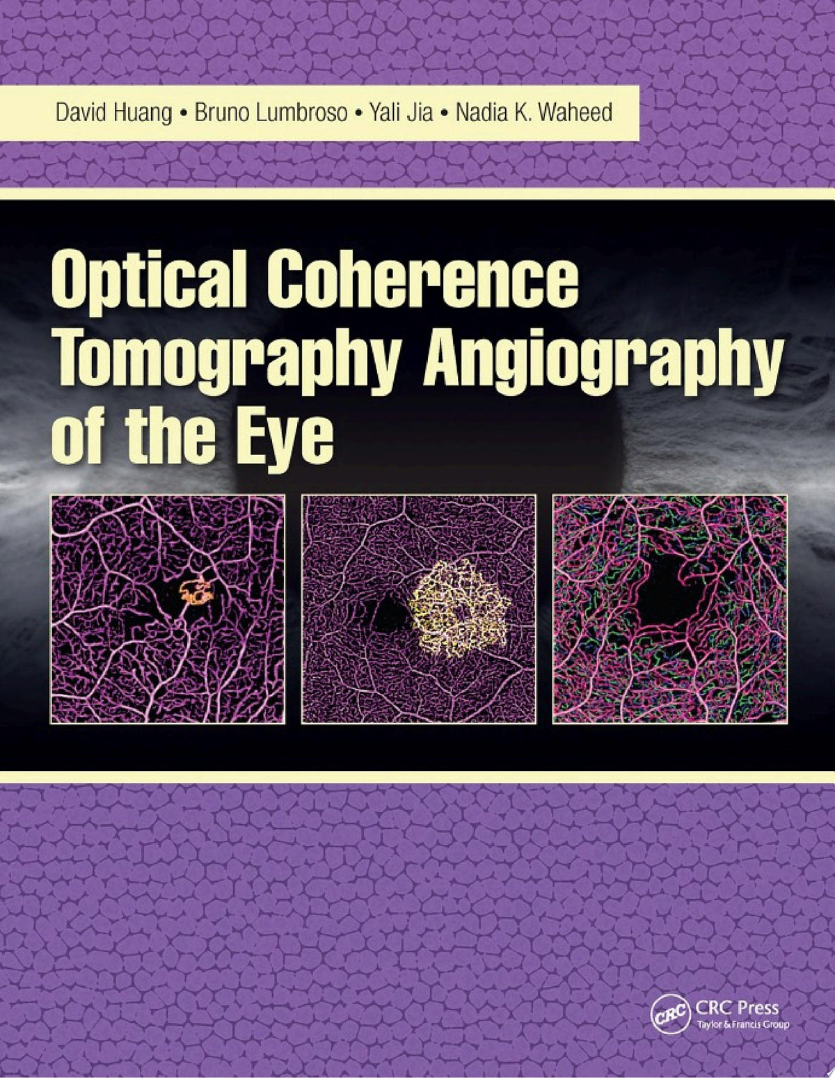 Optical Coherence Tomography Angiography of the Eye 1st Edition PDF