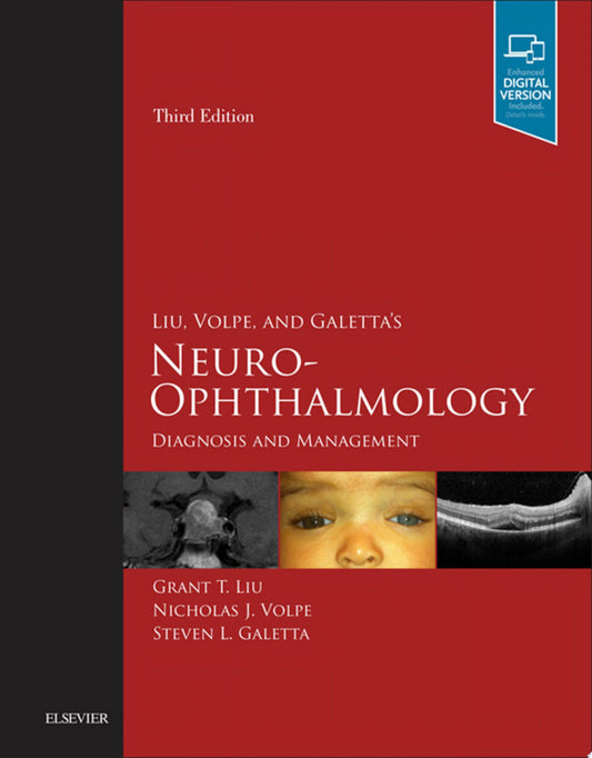 Neuro-Ophthalmology: Diagnosis and Management 3rd Edition by Elsevier PDF