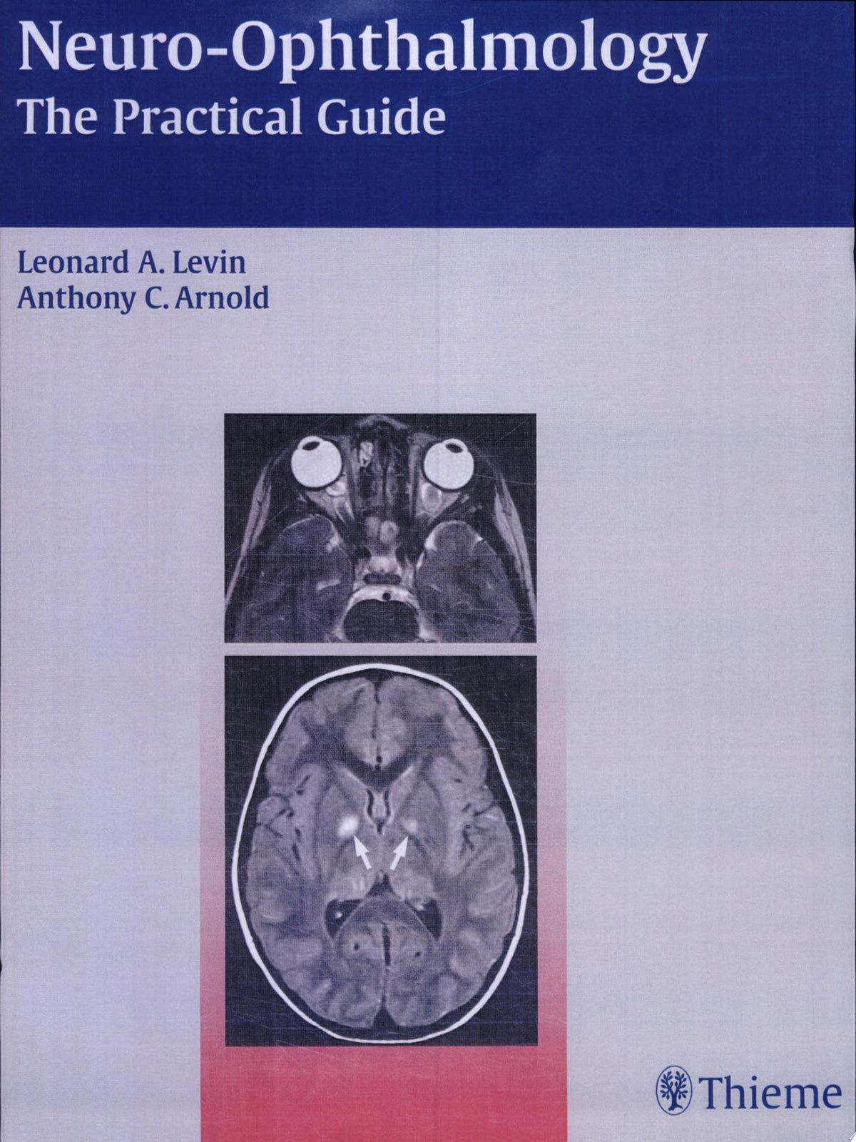 Neuro-Ophthalmology: The Practical Guide 1st Edition by Thieme PDF