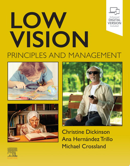 Low Vision: Principles and Management 1st Edition by Elsevier PDF