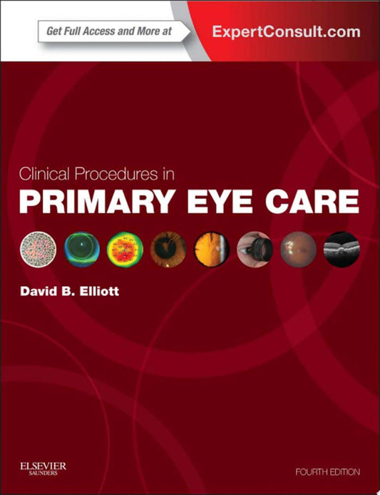 Clinical Procedures in Primary Eye Care 4th Edition by Elsevier PDF