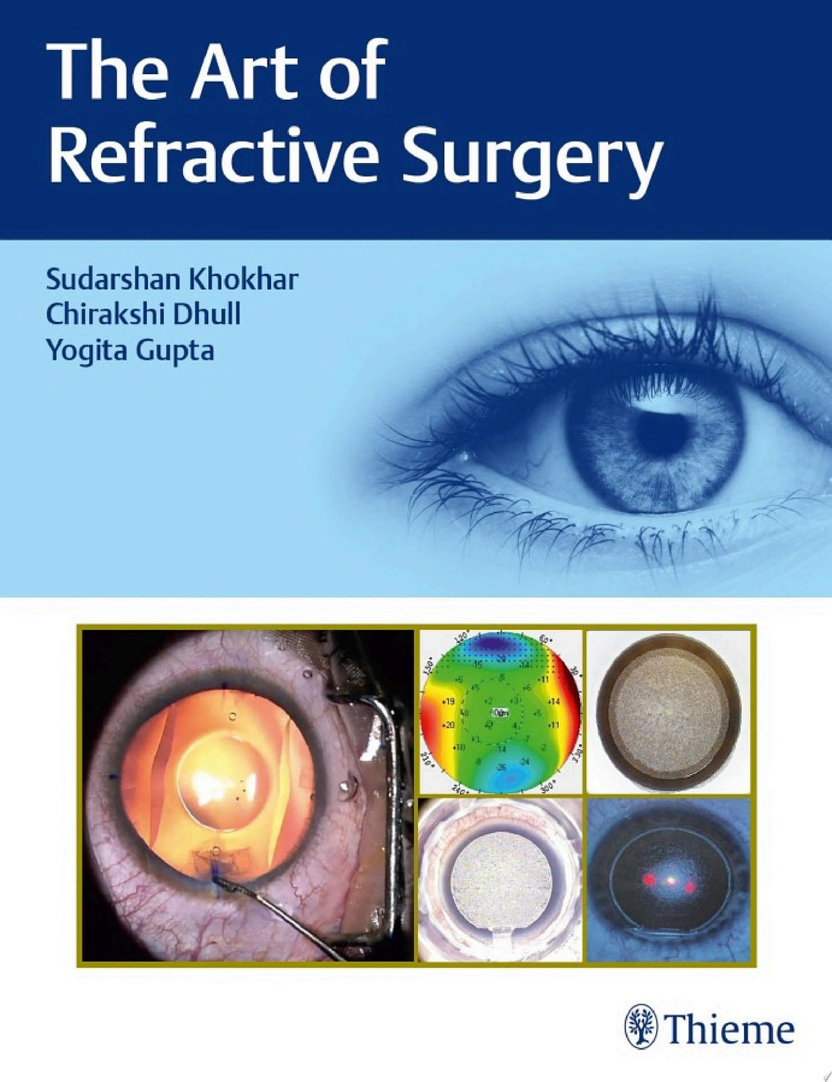 The Art of Refractive Surgery 1st Edition by Dhull PDF