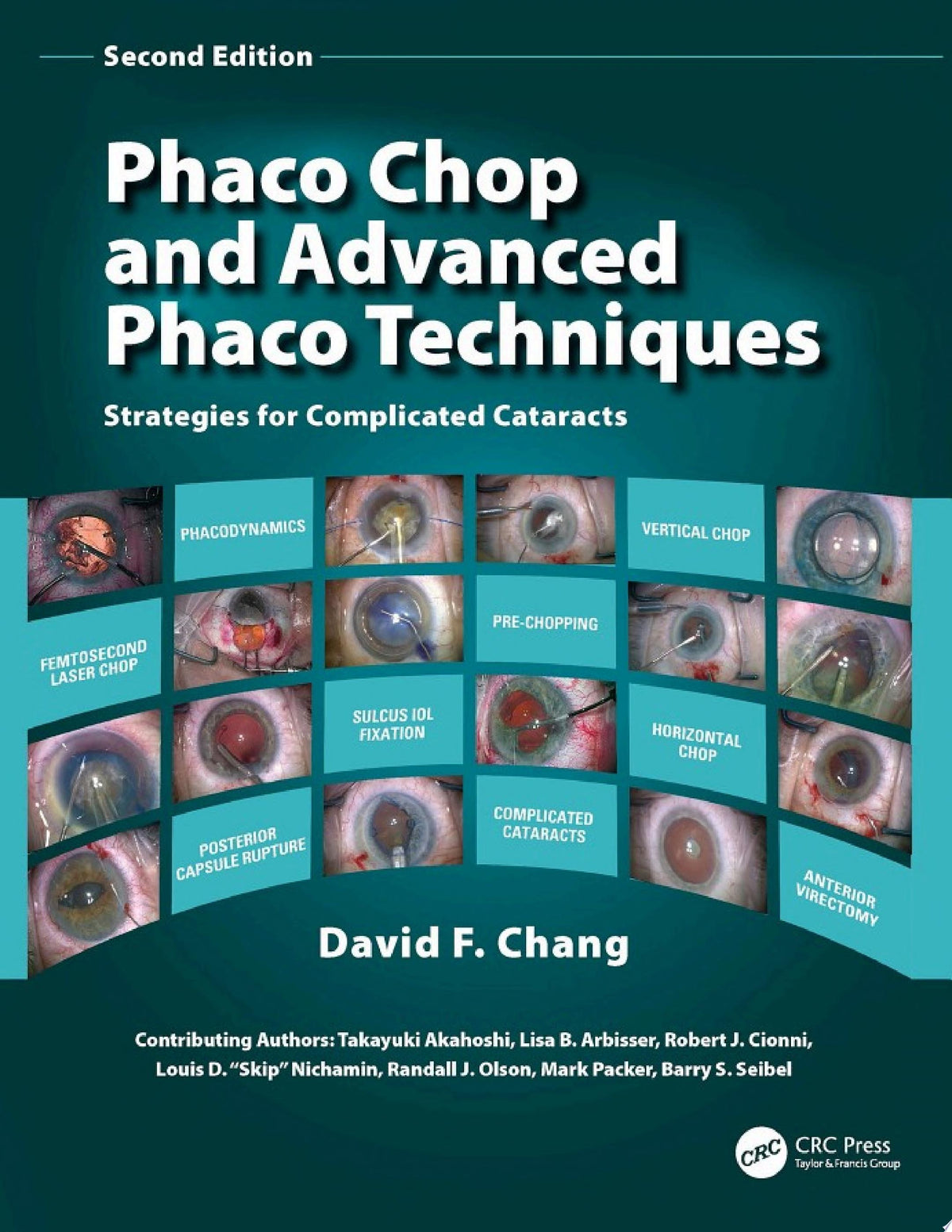 Phaco Chop and Advanced Phaco Techniques 1st Edition by Chang PDF