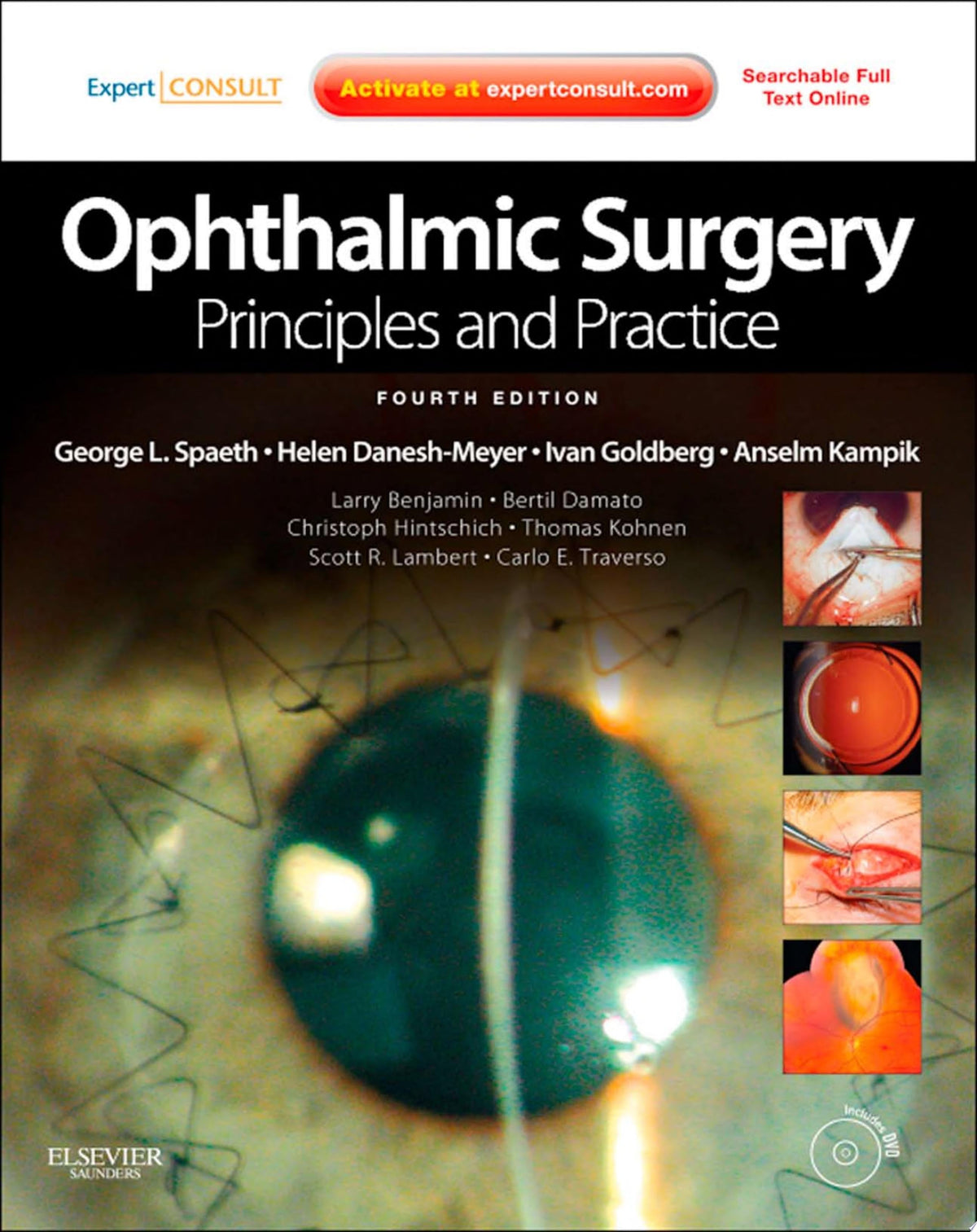 Ophthalmic Surgery: Principles and Practice 4th Edition by Elsevier PDF