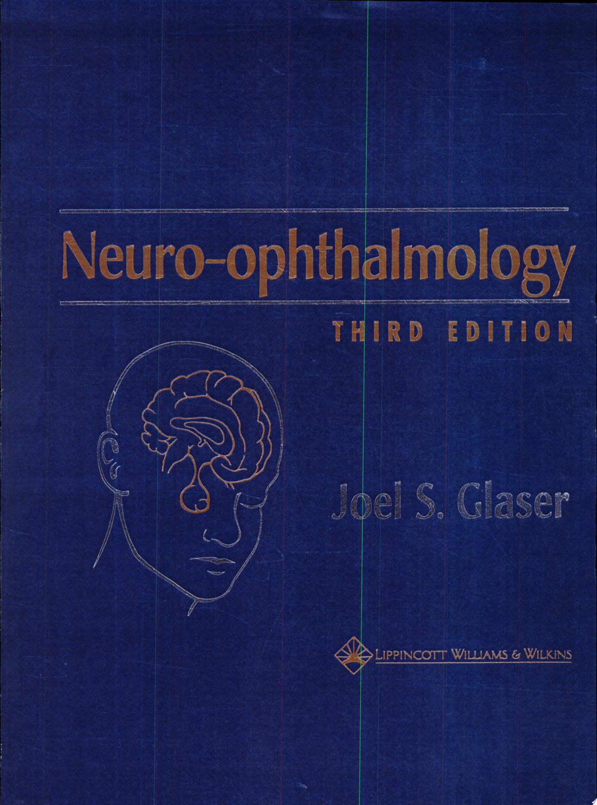 Neuro-Ophthalmology 1st Edition by Other Publisher PDF