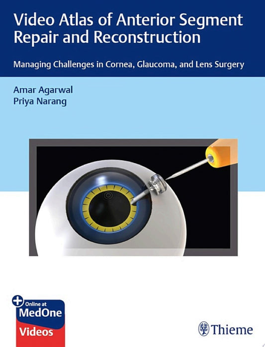 Video Atlas of Anterior Segment Repair and Reconstruction 1st Edition by Agarwal PDF