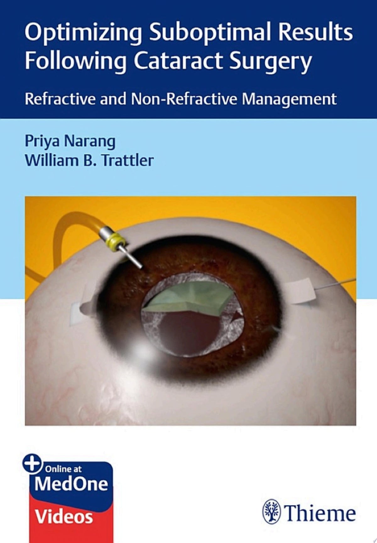 Optimizing Suboptimal Results Following Cataract Surgery 1st Edition by Narang PDF