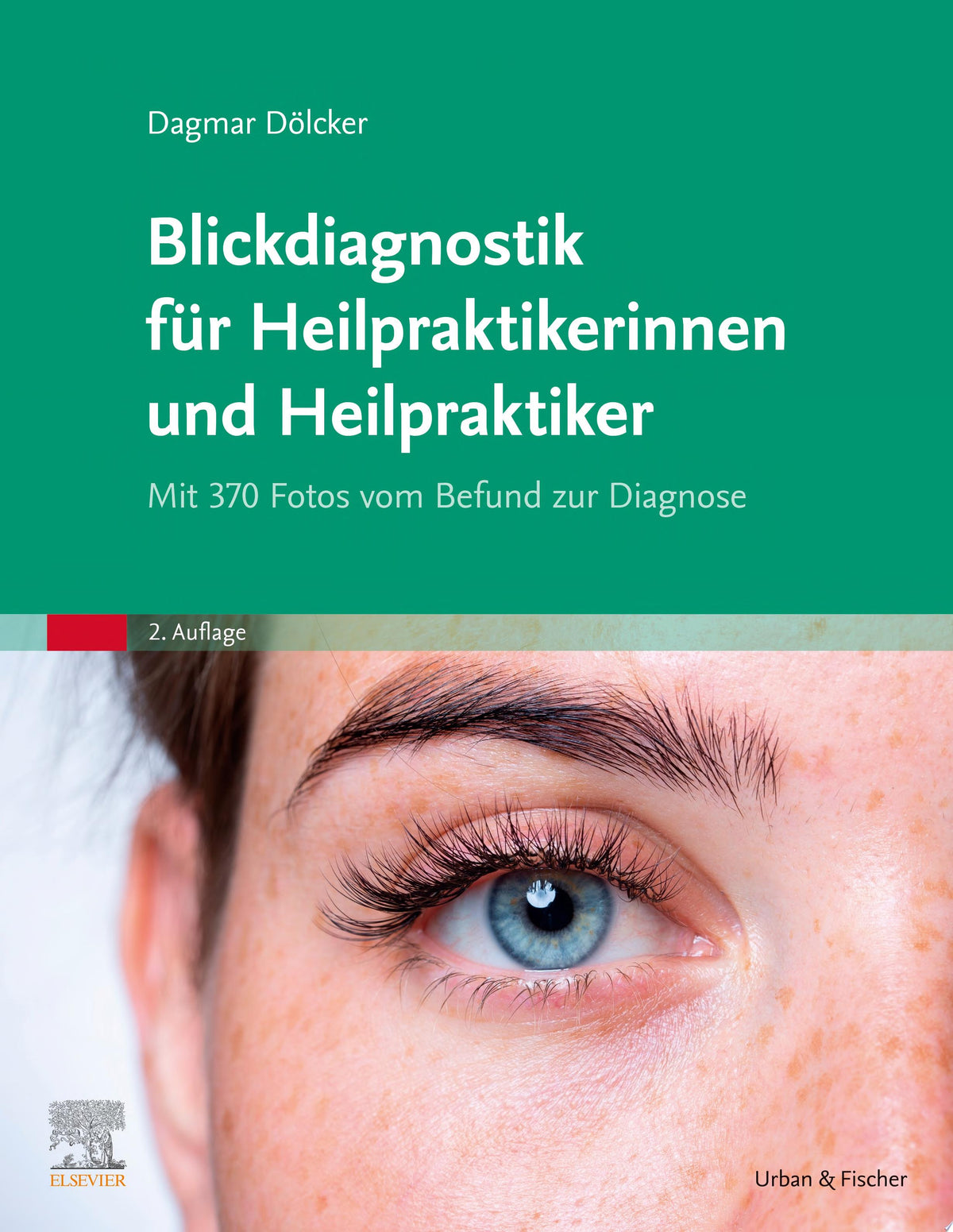 Cornea: Fundamentals Diagnosis and Management 3rd Edition by Dölcker PDF