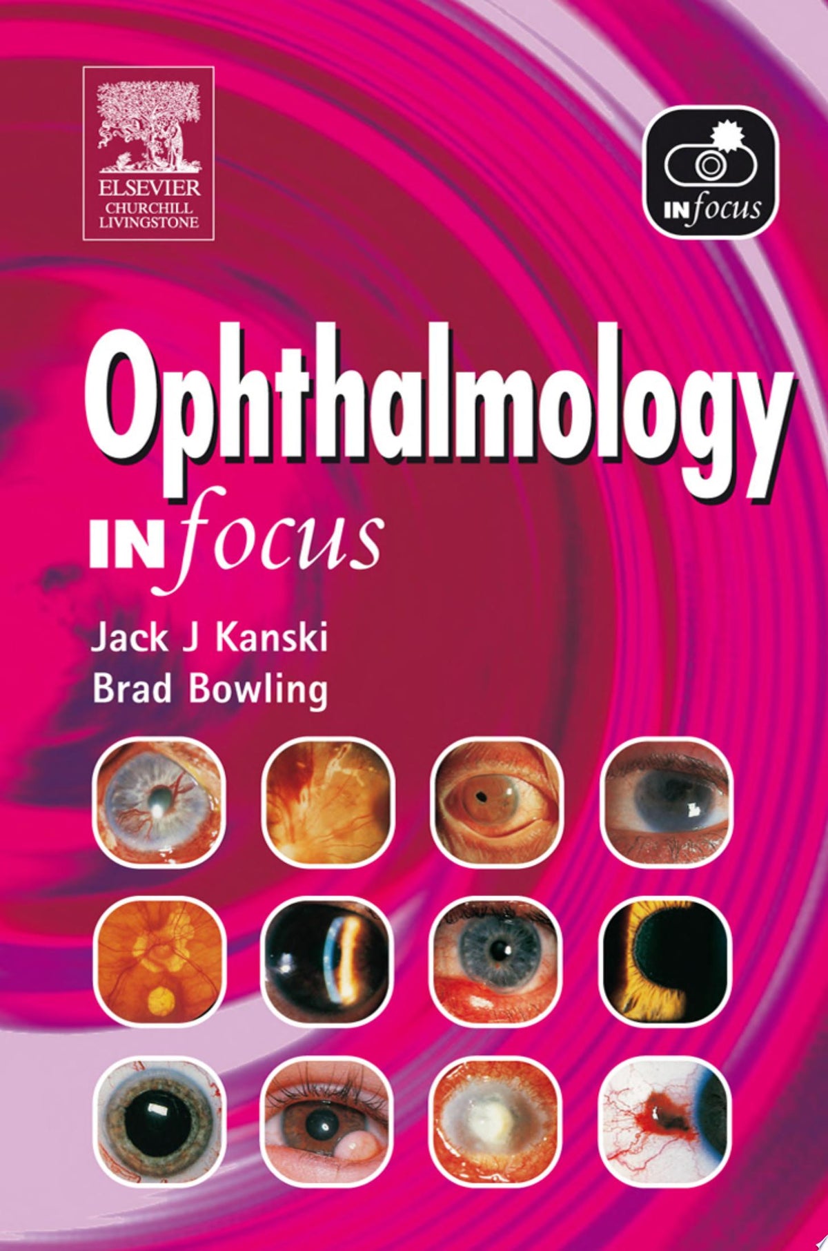 Ophthalmology In Focus 1st Edition by Elsevier PDF
