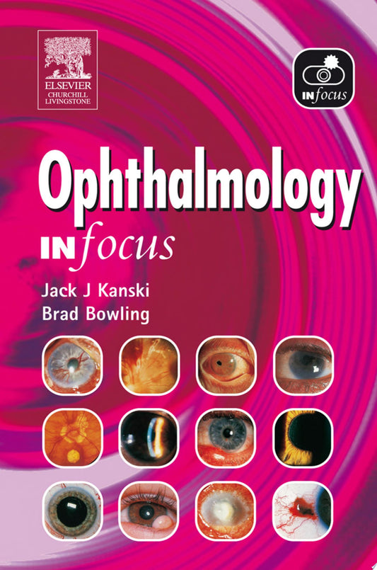 Ophthalmology In Focus 1st Edition by Elsevier PDF
