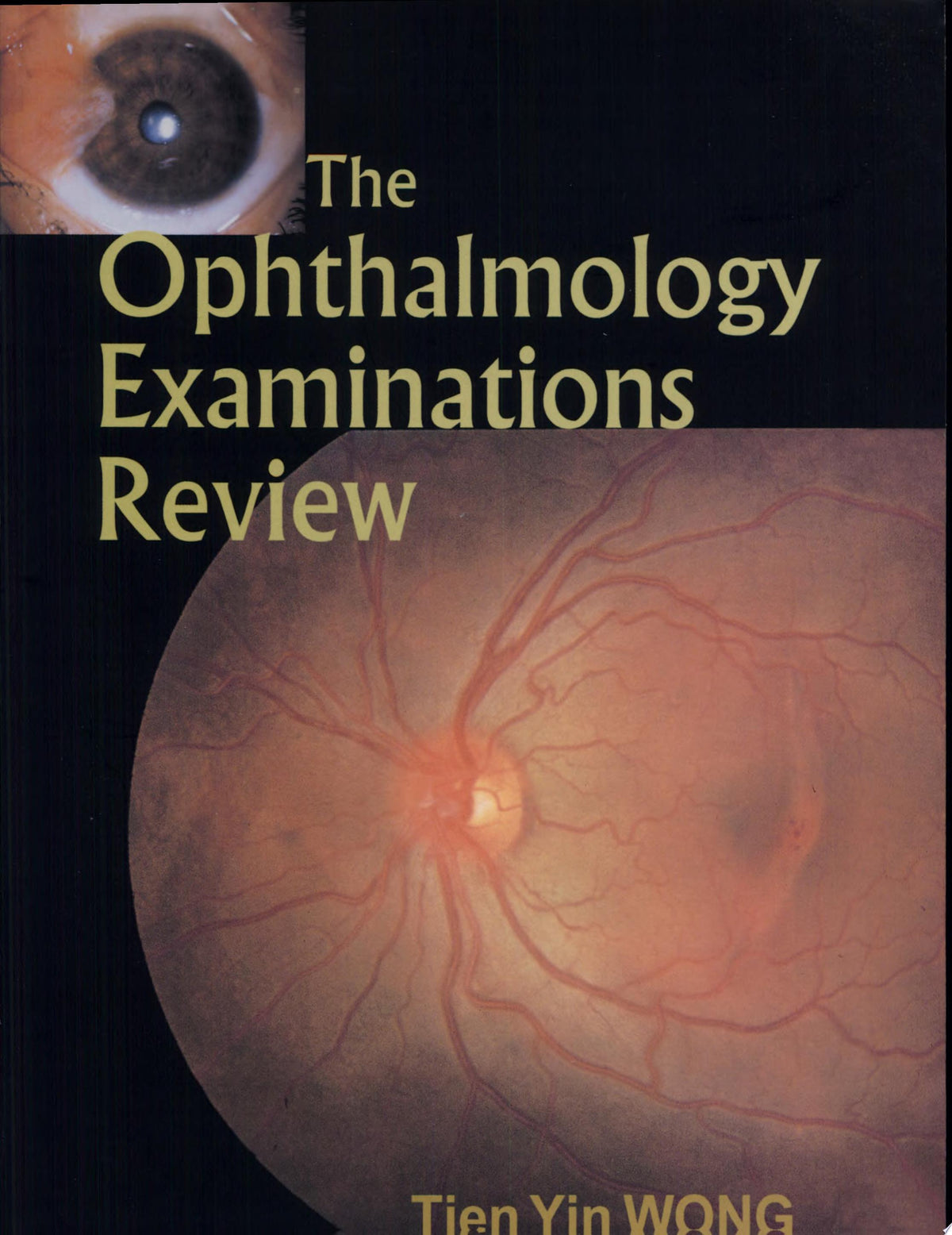 Ophthalmology Review 3rd Edition PDF