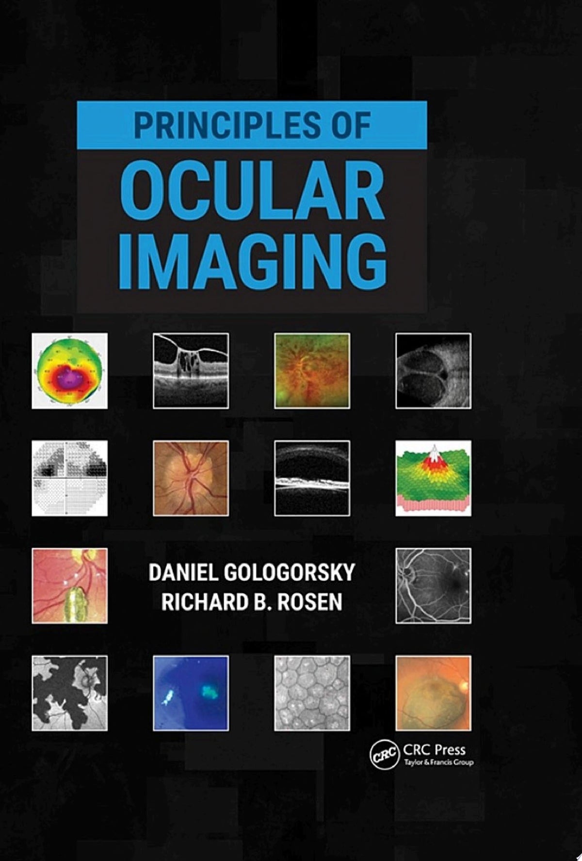 Principles of Ocular Imaging 1st Edition by Gologorsky PDF