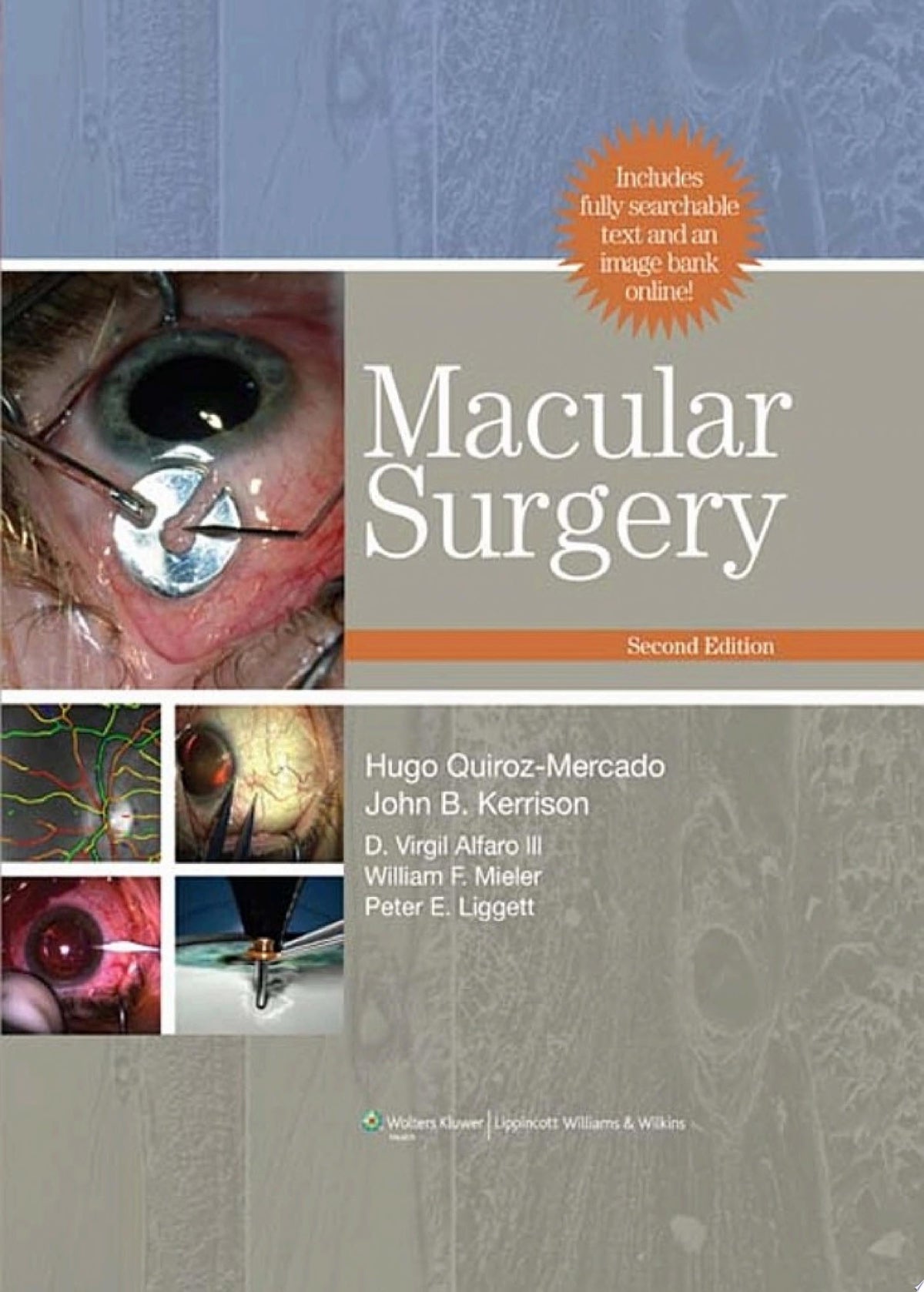 Macular Surgery 2nd Edition by LWW PDF