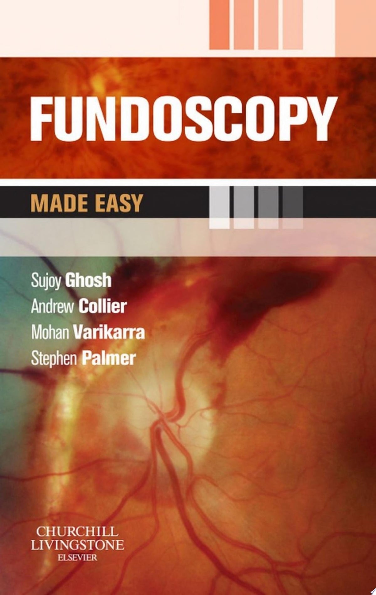Fundoscopy Made Easy 1st Edition PDF