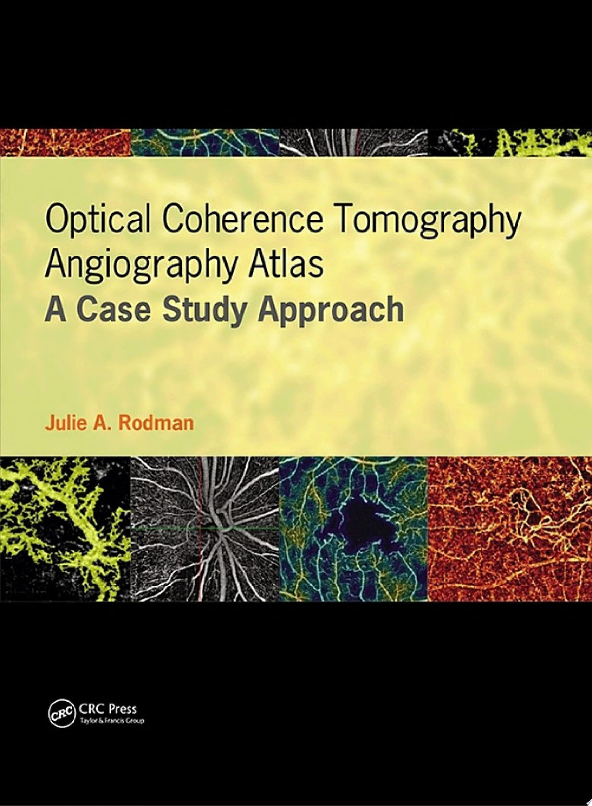 Optical Coherence Tomography Angiography Atlas 1st Edition by Esmaili PDF