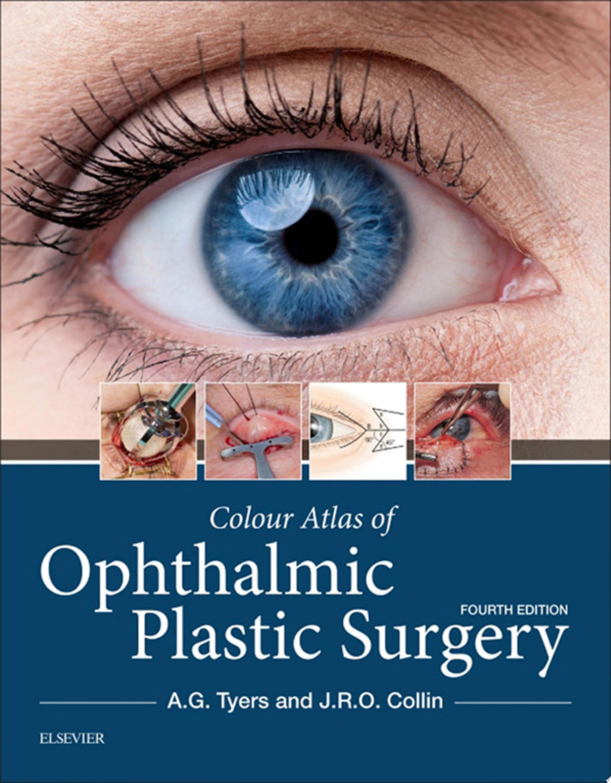 Colour Atlas of Ophthalmic Plastic Surgery 4th Edition by Elsevier PDF