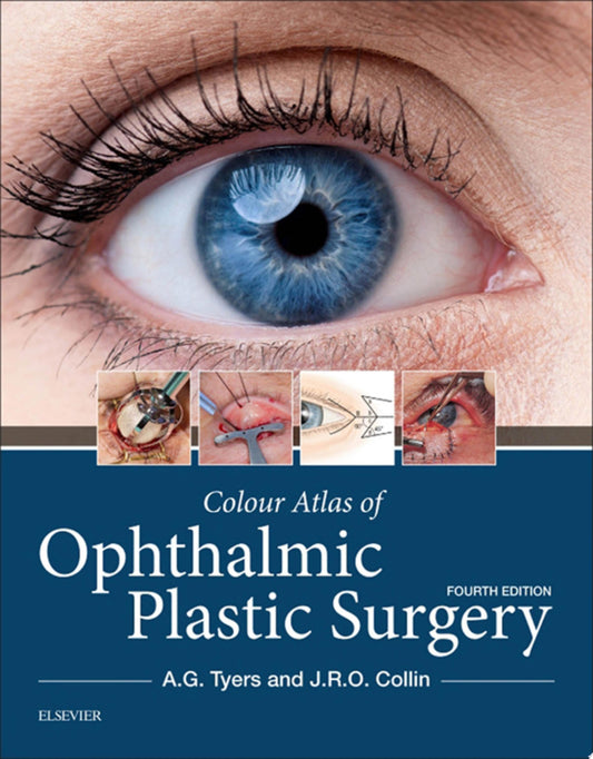 Colour Atlas of Ophthalmic Plastic Surgery 4th Edition by Elsevier PDF