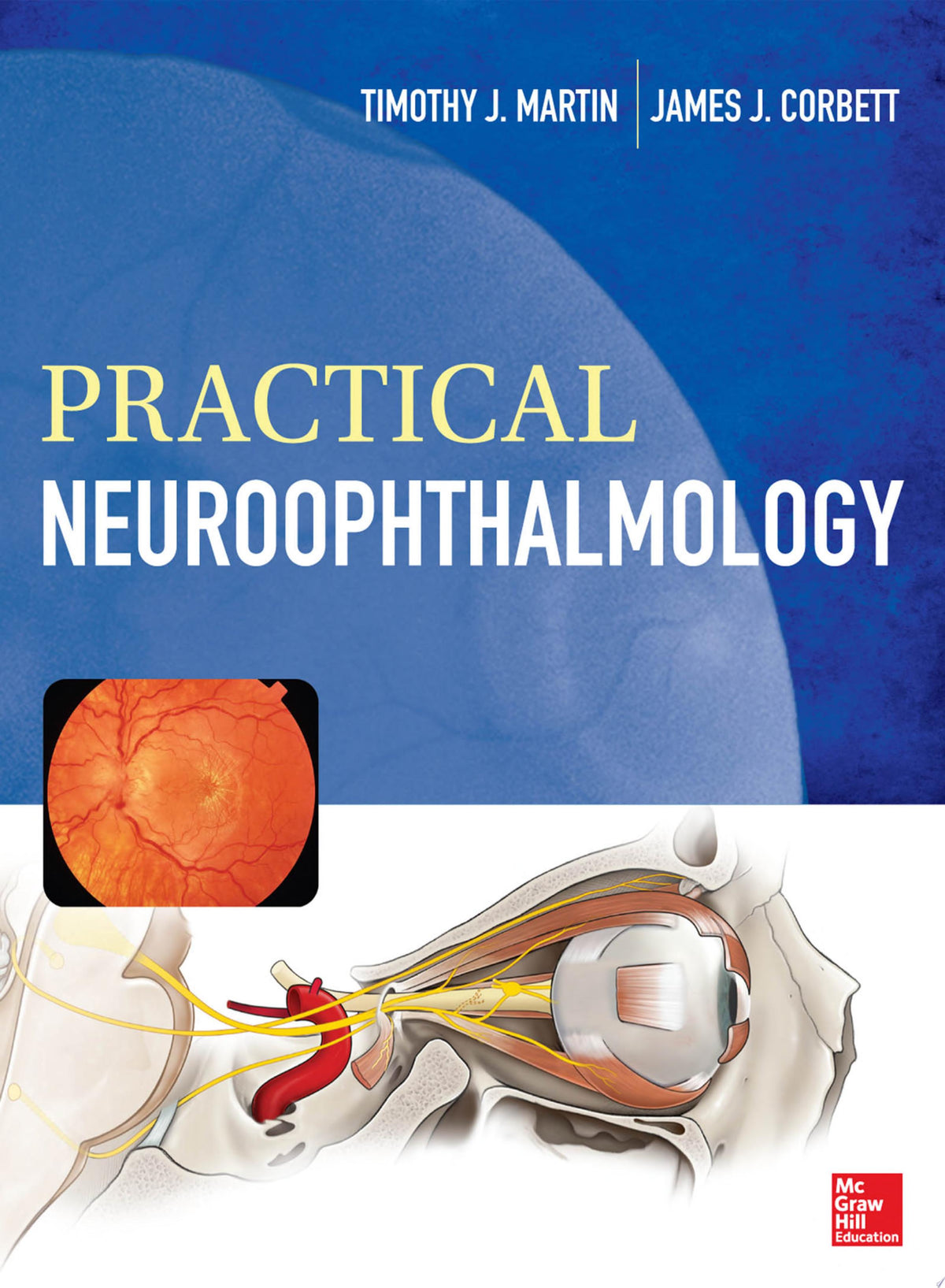 Practical Neuroophthalmology 1st Edition by McGraw Hill PDF