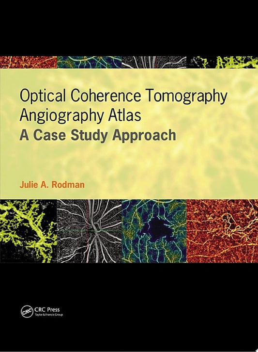 Optical Coherence Tomography Angiography Atlas 1st Edition by Esmaili PDF