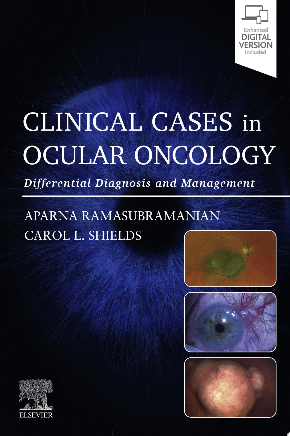 Clinical Cases in Ocular Oncology 1st Edition by Elsevier PDF