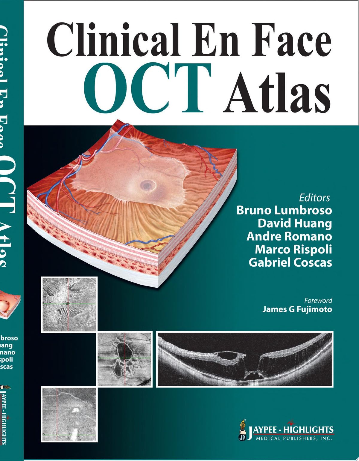 OCT Atlas 1st Edition by Coscas PDF
