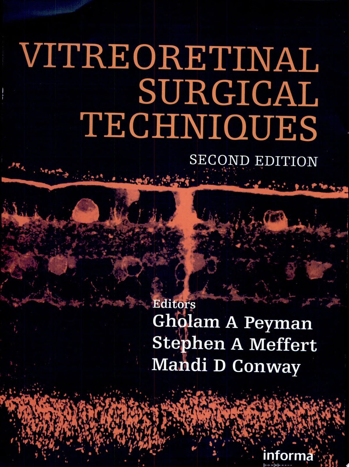 Age-Related Macular Degeneration 2nd Edition PDF