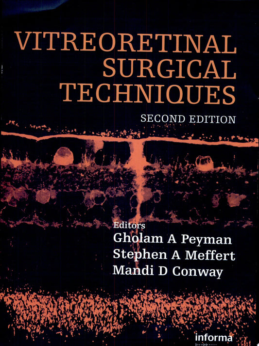 Age-Related Macular Degeneration 2nd Edition PDF