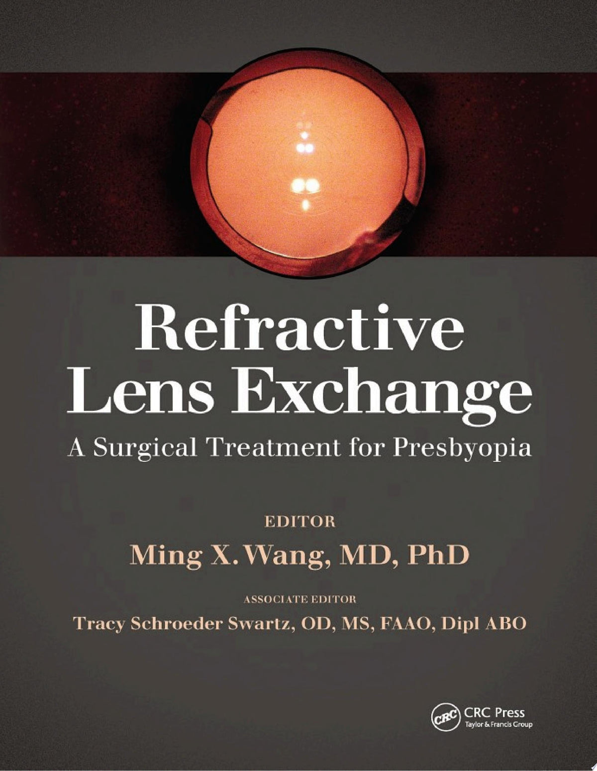 Refractive Lens Exchange 1st Edition by Ming Wang PDF