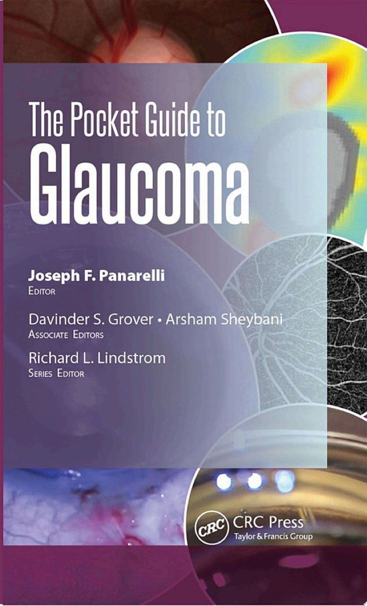 The Pocket Guide to Glaucoma 1st Edition by Grover PDF