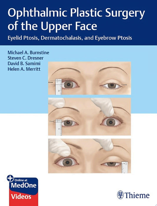 Ophthalmic Plastic Surgery of the Upper Face 1st Edition by Thieme PDF