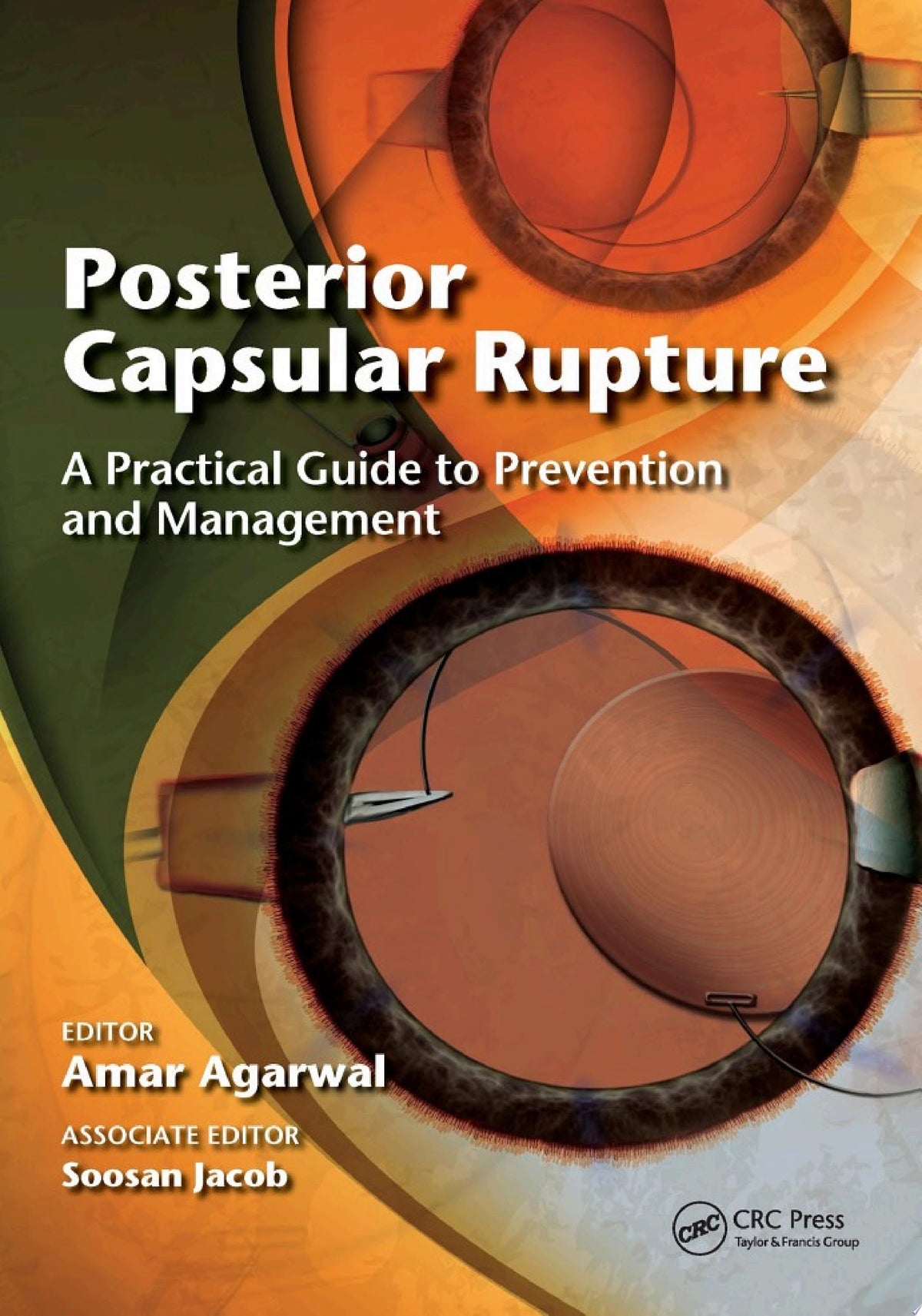 Posterior Capsular Rupture 1st Edition by Slack Incorporated PDF