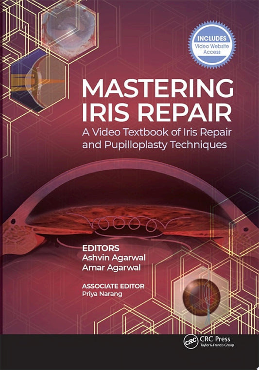 Mastering Iris Repair 1st Edition by Slack Incorporated PDF