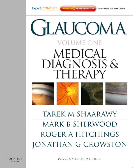 Glaucoma 1st Edition PDF