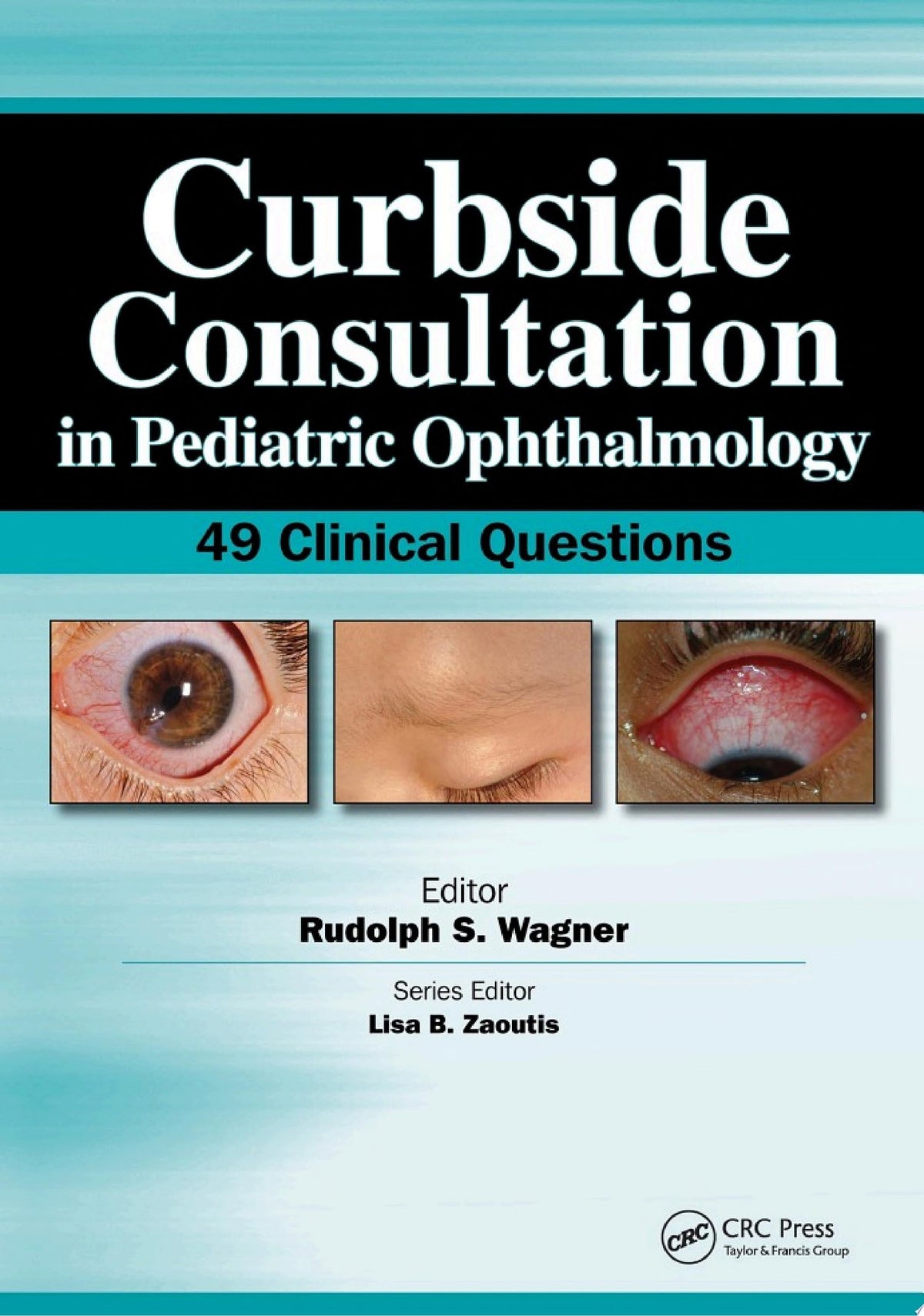 Curbside Consultation in Pediatric Ophthalmology 1st Edition by Slack Incorporated PDF