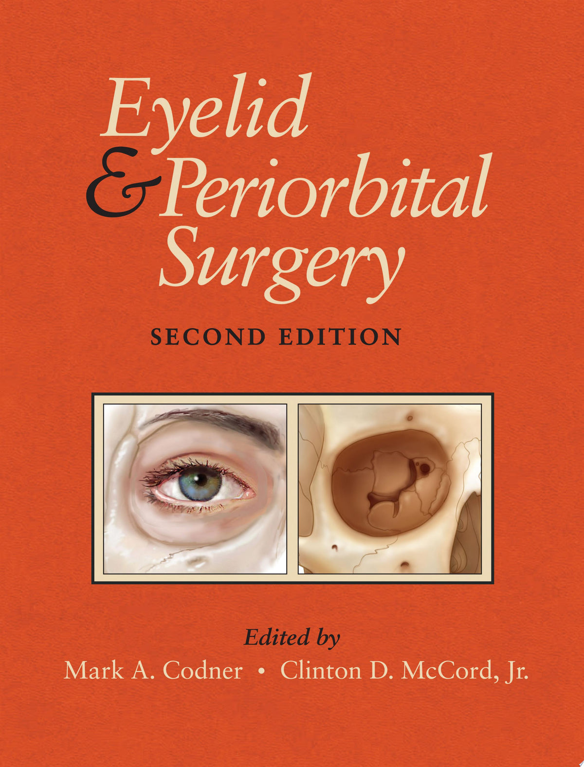 Eyelid and Periorbital Surgery 2nd Edition by CRC Press PDF