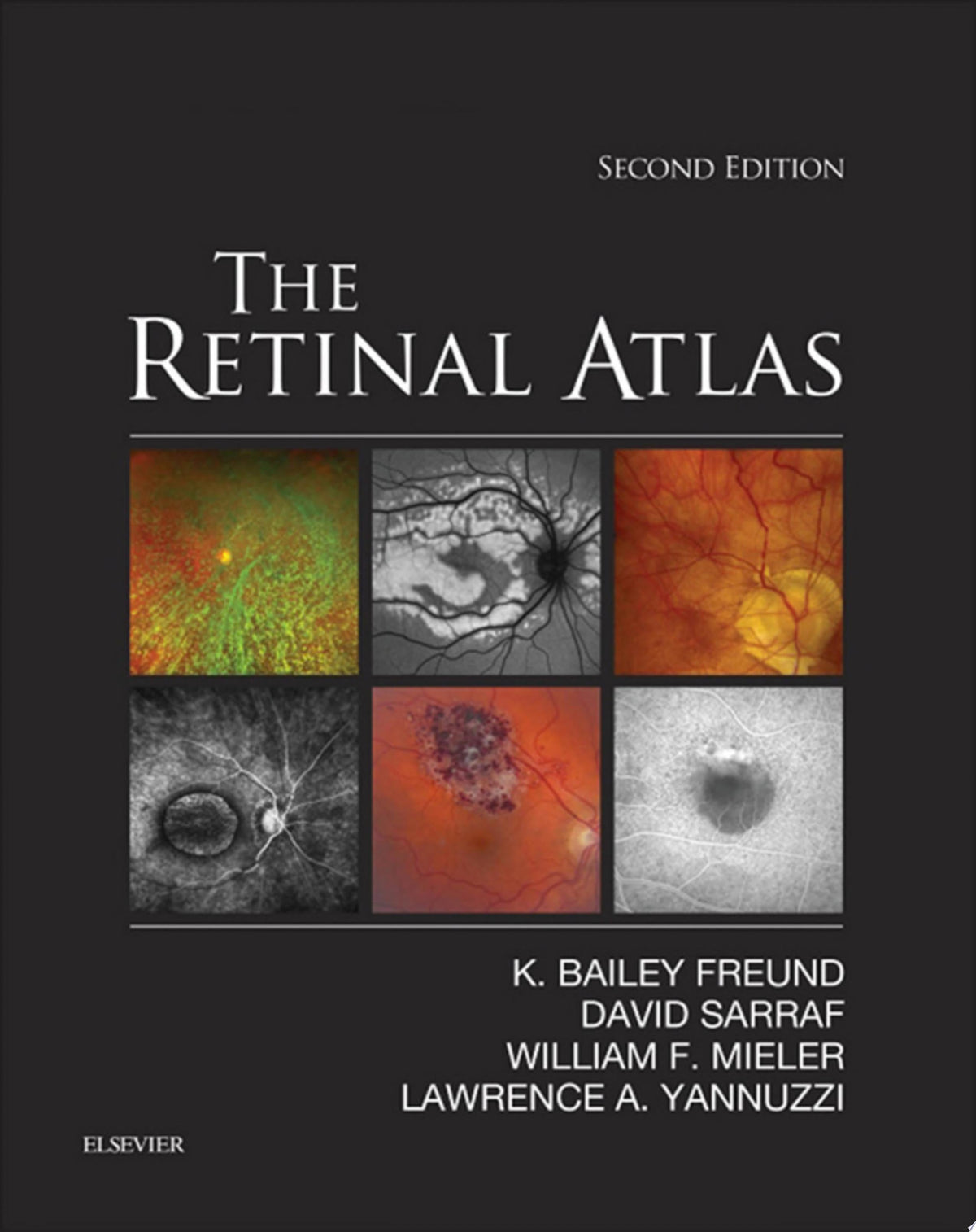The Retinal Atlas 1st Edition PDF